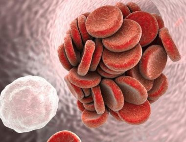 Θρόμβωση: Οι τροφές που αυξάνουν τον κίνδυνο και ο ρόλος της ασπιρίνης!